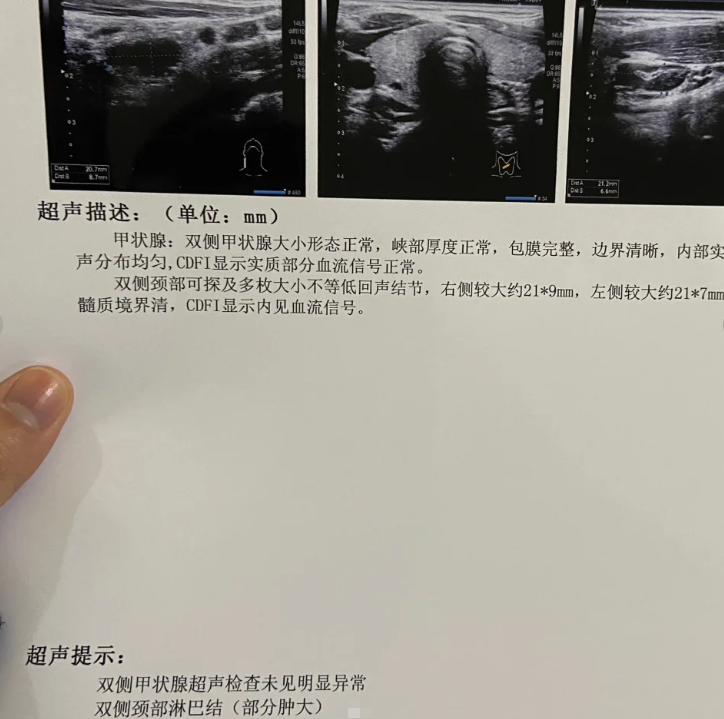 肚子上长了个小肉球,最常见的原因是皮脂腺囊肿或脂肪瘤