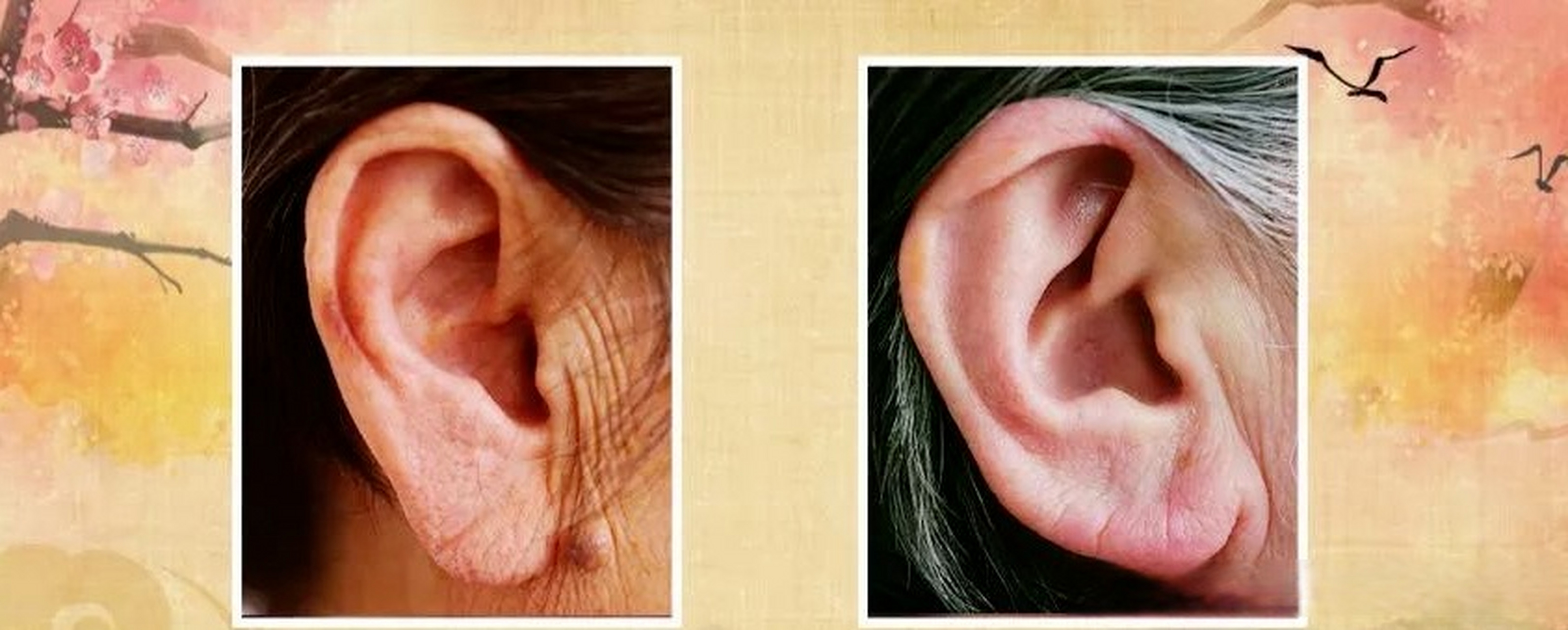 一套"耳朵保健操"做起来~】面相学上有"耳垂大的人更有福",那么"大耳