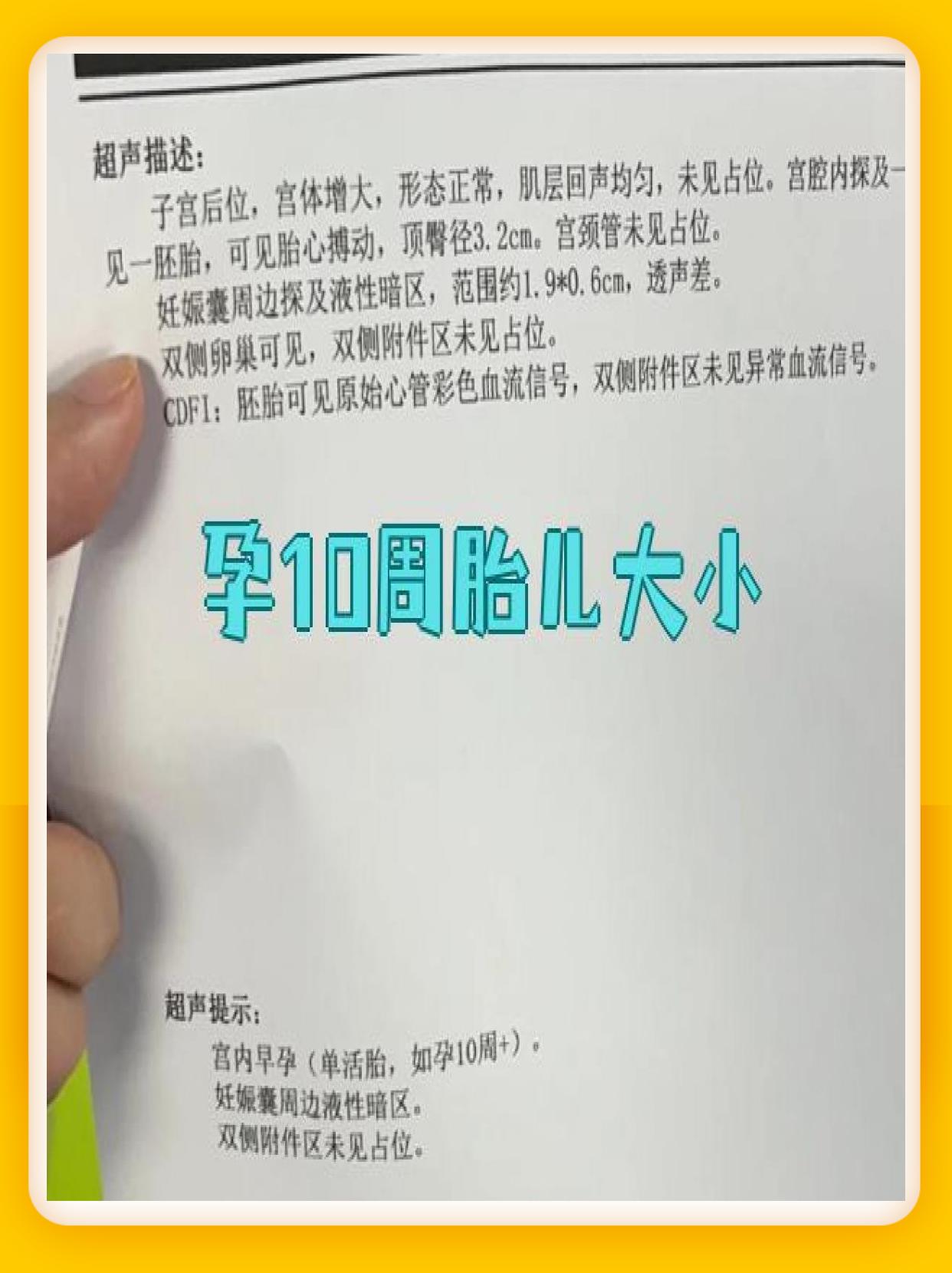 孕10周时胎儿长约3