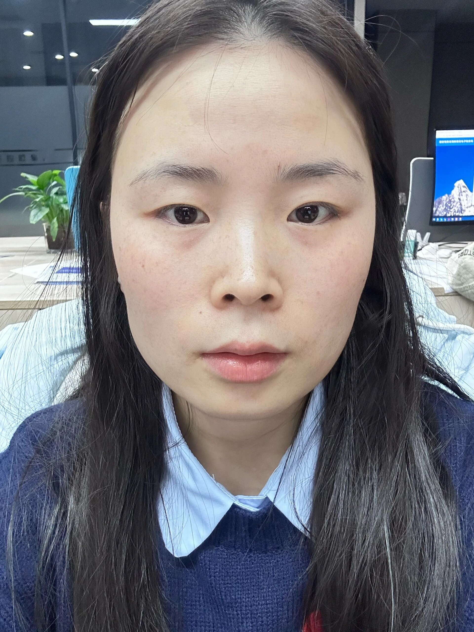 颧骨高 颧弓外扩 我想46615 好想敲碎我的颧骨