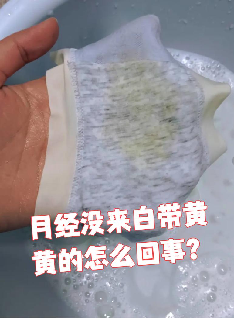 月经没来且白带发黄,可能有几种常见原因,需要根据具体情况处理