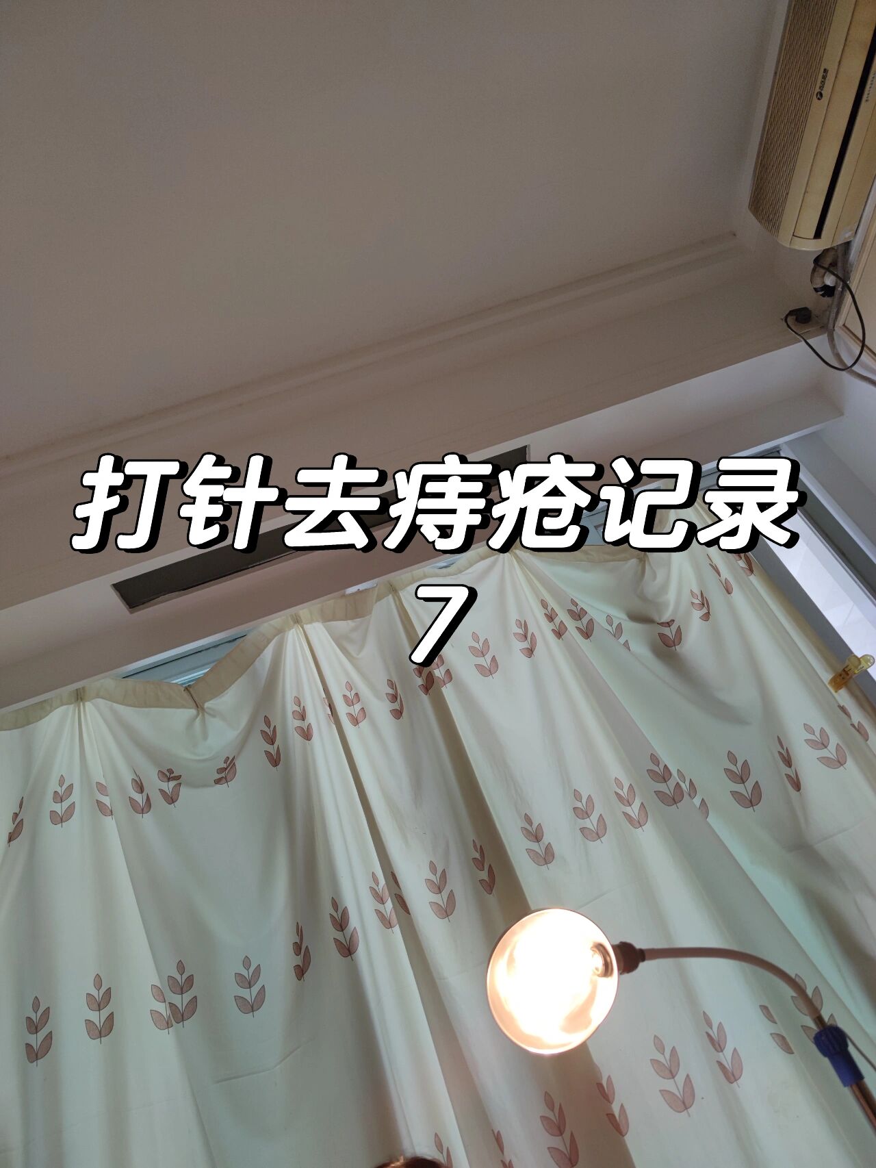 记第7次打针治疗去痔疮 这次打针痛死人了!