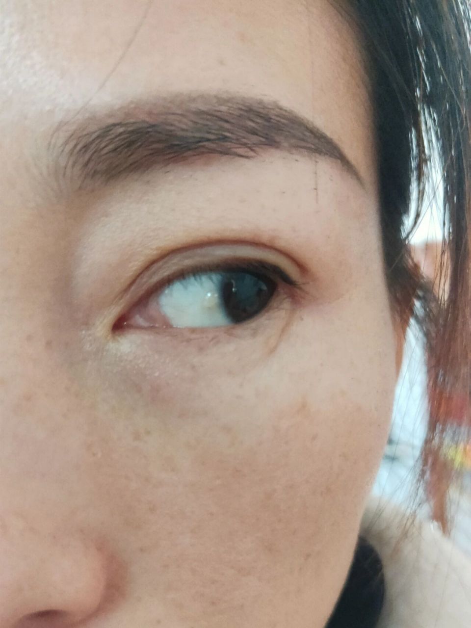 眼睛98里有白色凸起的水泡,咋回事