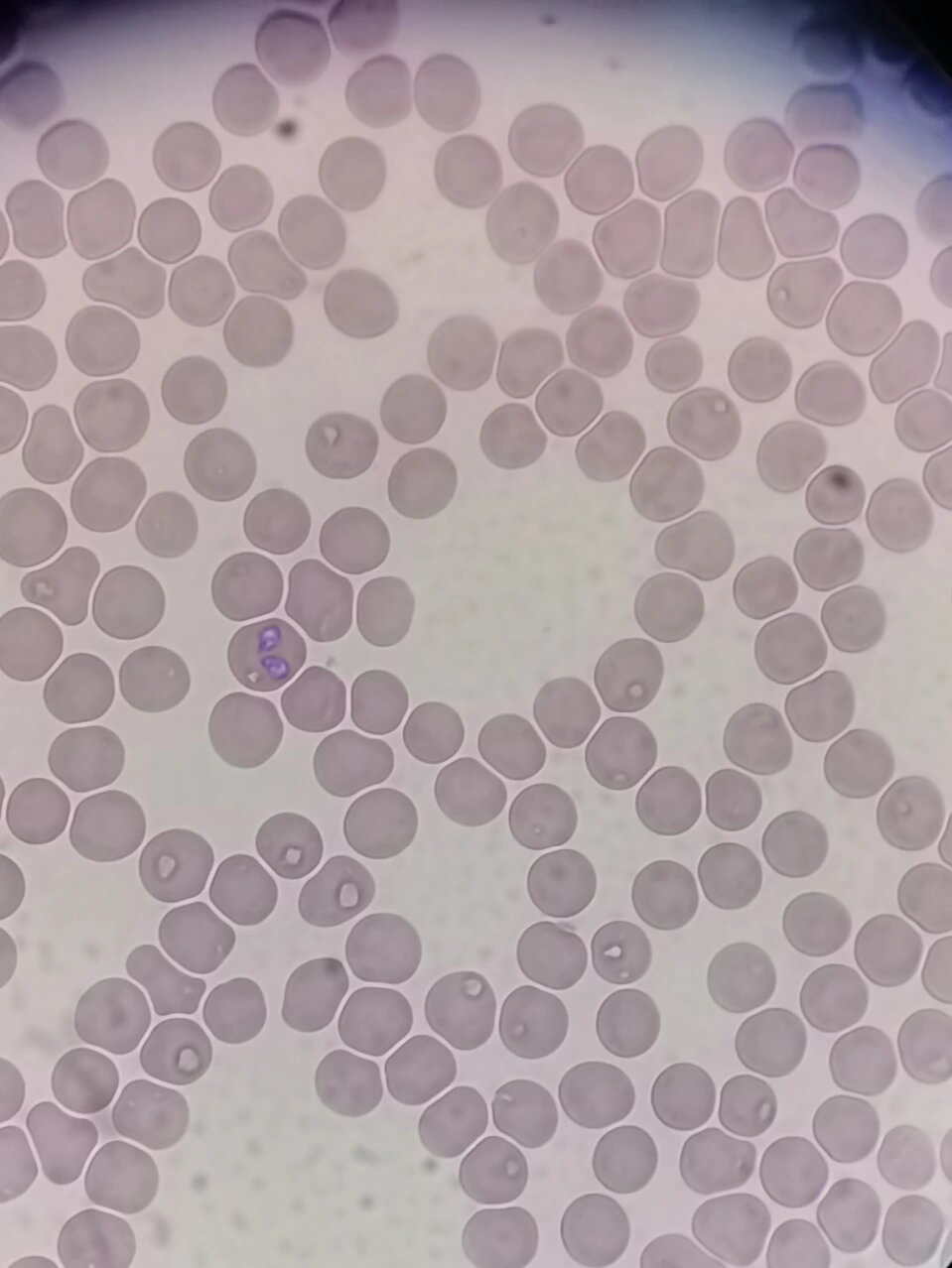 犬巴贝斯虫 犬巴贝斯虫又称梨形虫,由蜱虫传播导致的血液寄生虫,感染