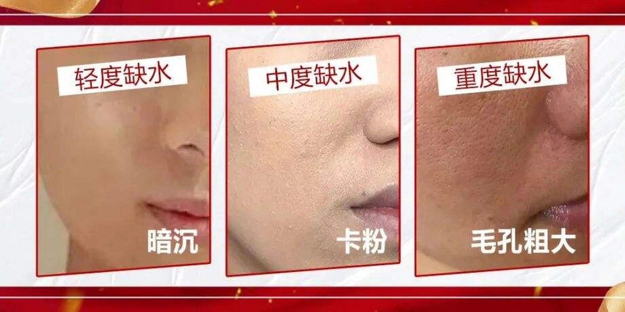 皮肤缺水的十个信号 皮肤缺水的十个信号: 1,感觉皮肤很紧绷,有时还出