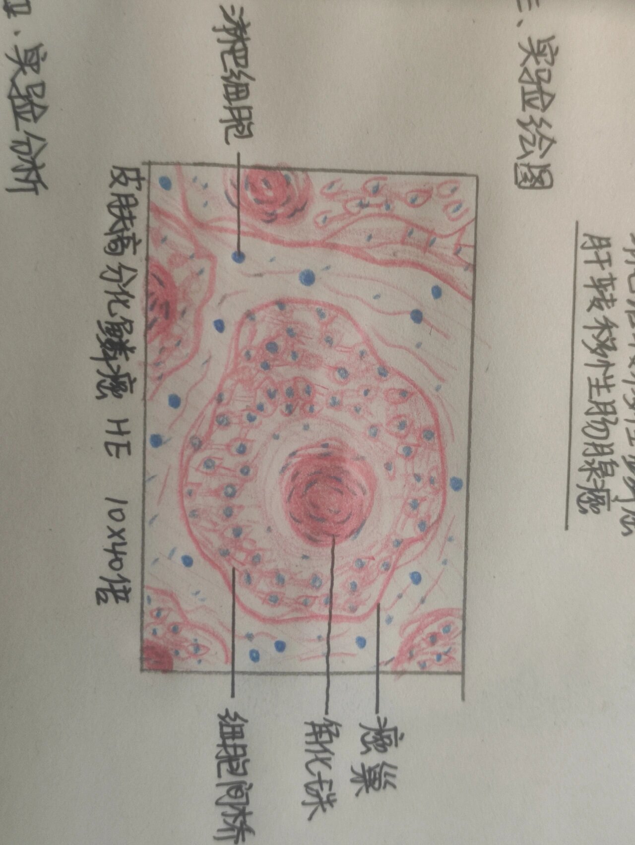 癌巢手绘图图片