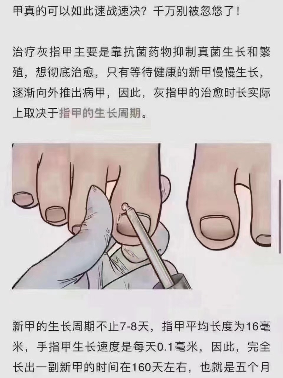 指甲生长过程图片