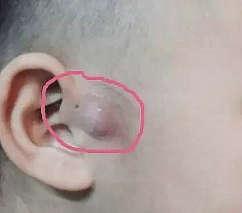 耳仓为什么是臭的