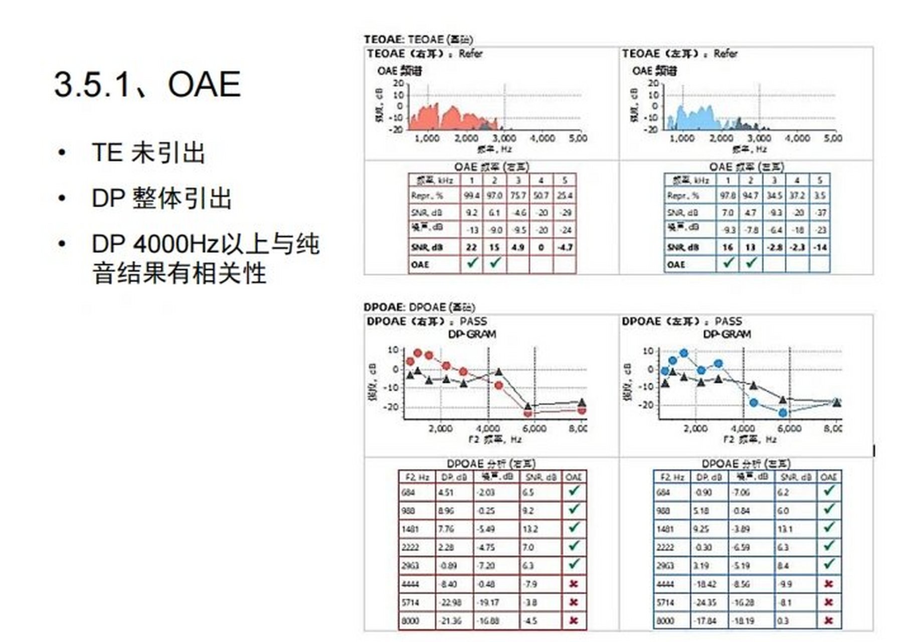 如何看懂听力检查报告(三)耳声发射 耳声发射检查临床应用于评估耳蜗
