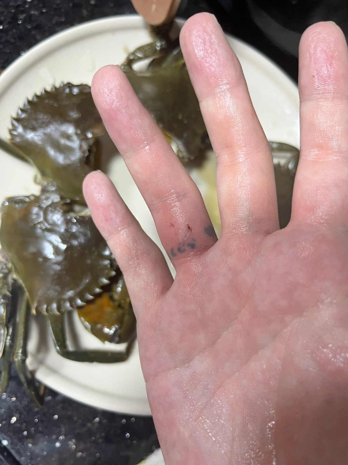 已经对半斩断的螃蟹为什么钳子还能把我夹到肉直接白掉再晚一秒掰开