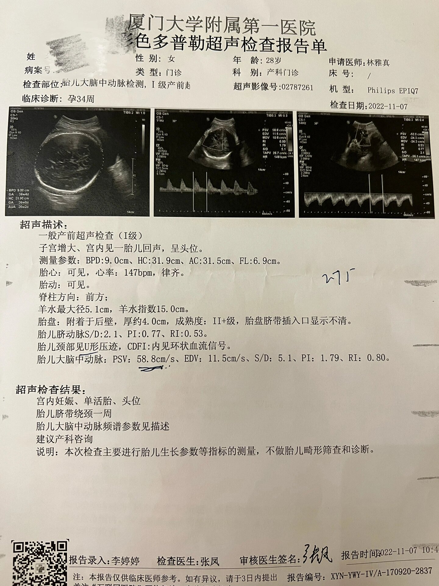 今天医生说我胎儿大脑中动脉临界值 上次做小排畸还一切正常呢,现在孕