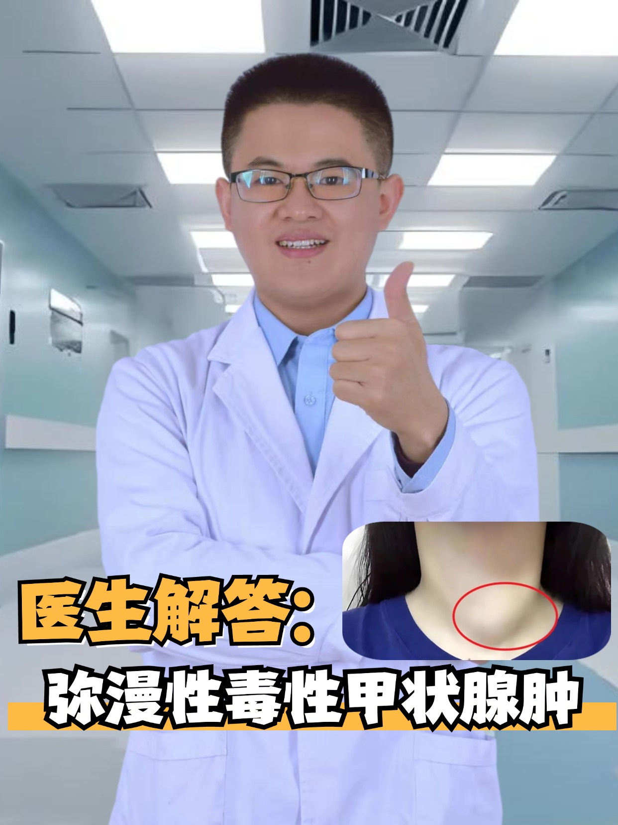 其主要特征是甲状腺弥漫性肿大,甲状腺功能亢进