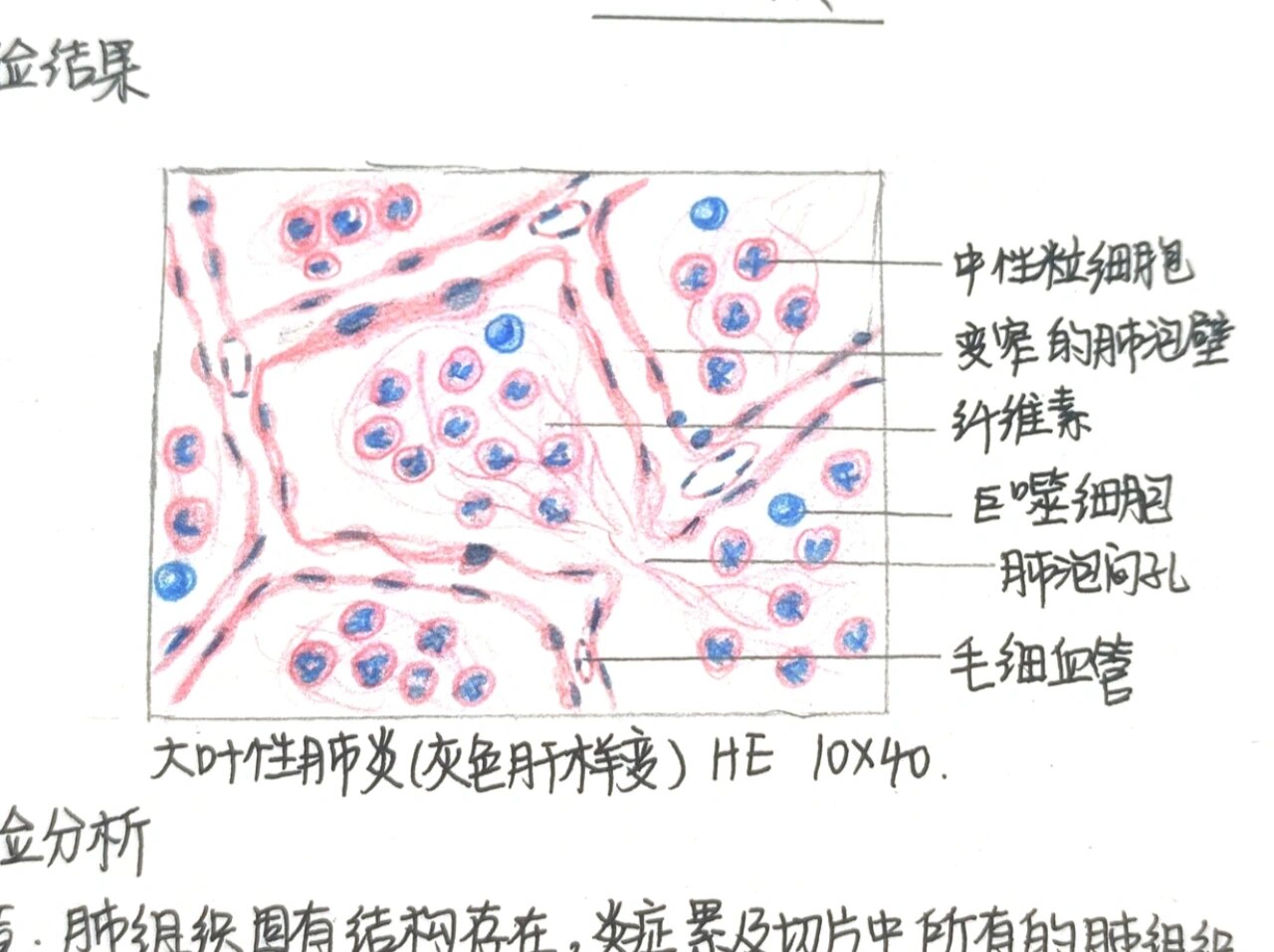 肺炎杆菌手绘图图片