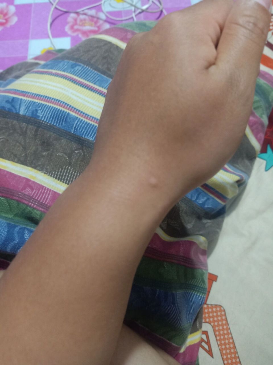 啊啊啊啊啊 睡觉被蚰蜒咬了!