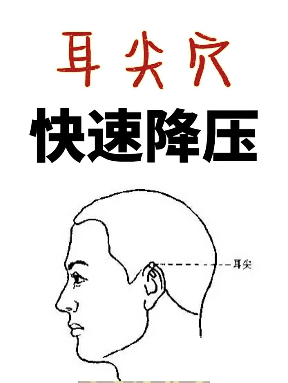 用耳尖穴快速降压781578157815 用耳尖穴降压的效果同