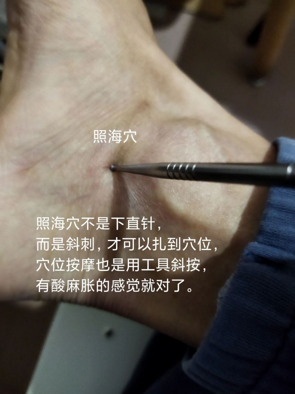 支沟 照海,便秘立竿见影,倪师诚不欺我 今天早上一起床国际惯例蹲大便