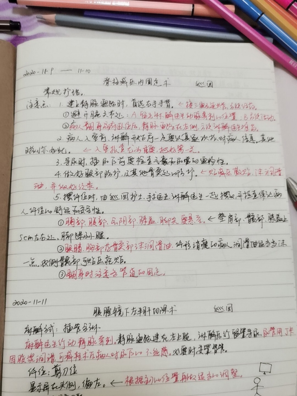 手术笔记:腹腔镜下肝叶切除术