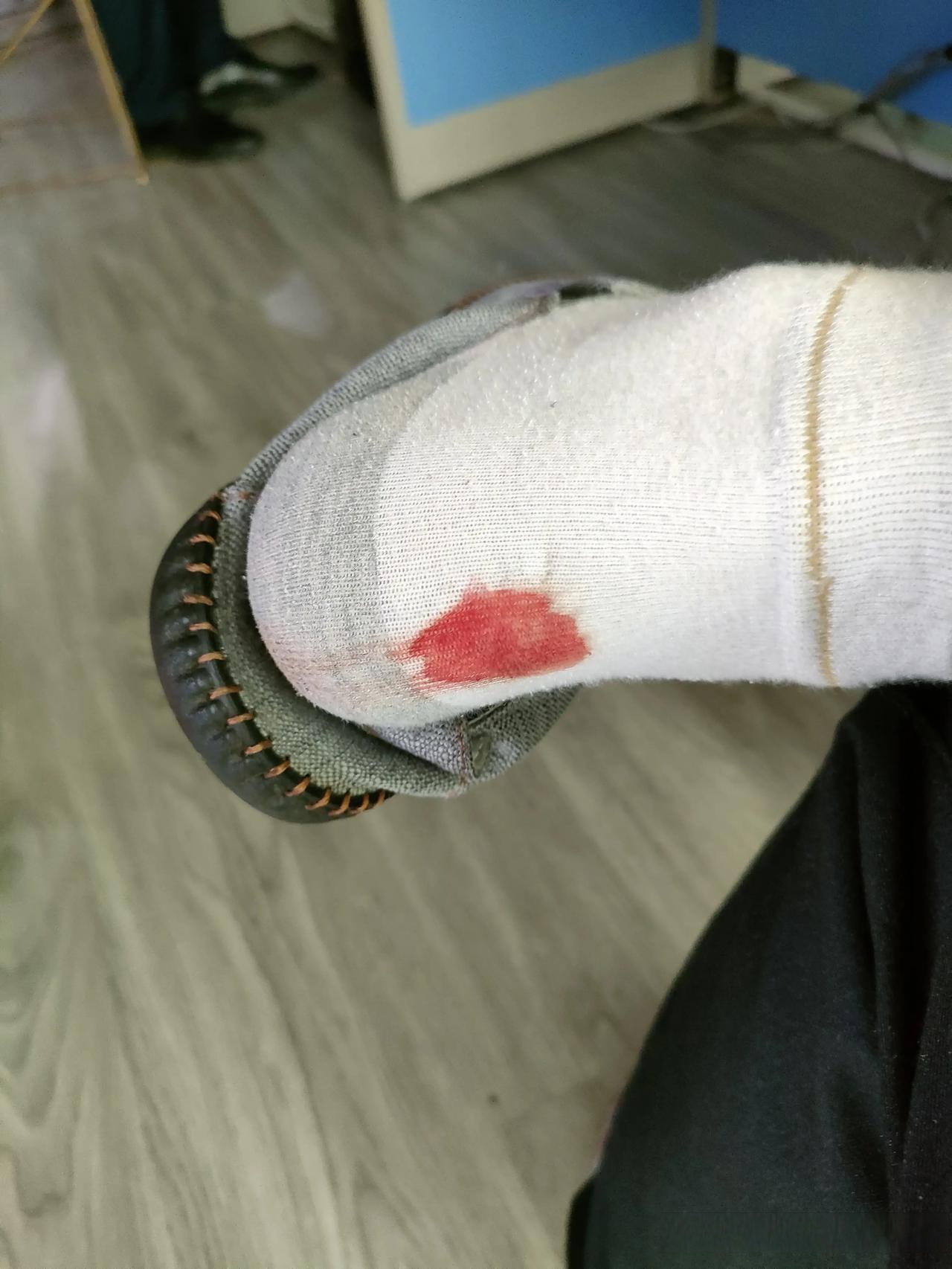 这样可以避免等红绿灯时误拉油门造成事故刚我就是这样摔了一跤