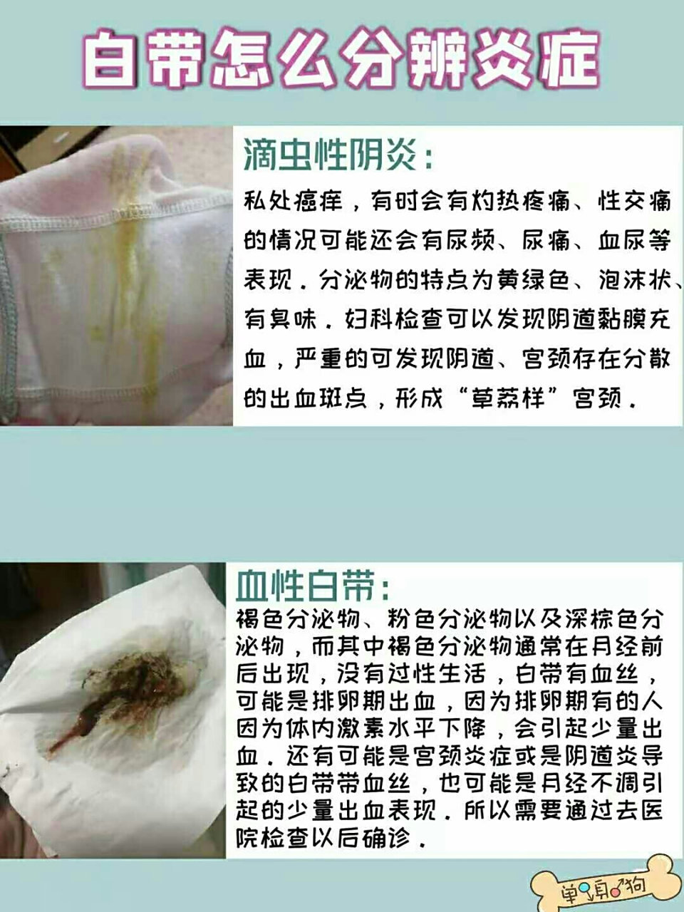 妇科炎症自测表 很多姐妹都对妇科检查很恐惧,害怕,尴尬,我也是的