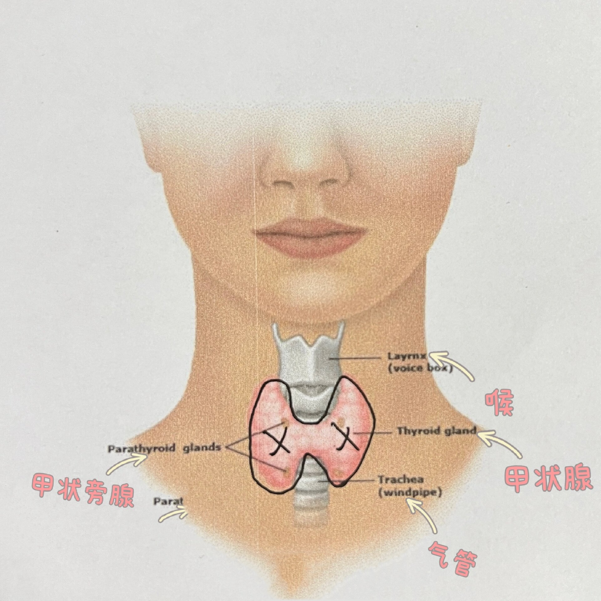 甲状腺淋巴位置图图片