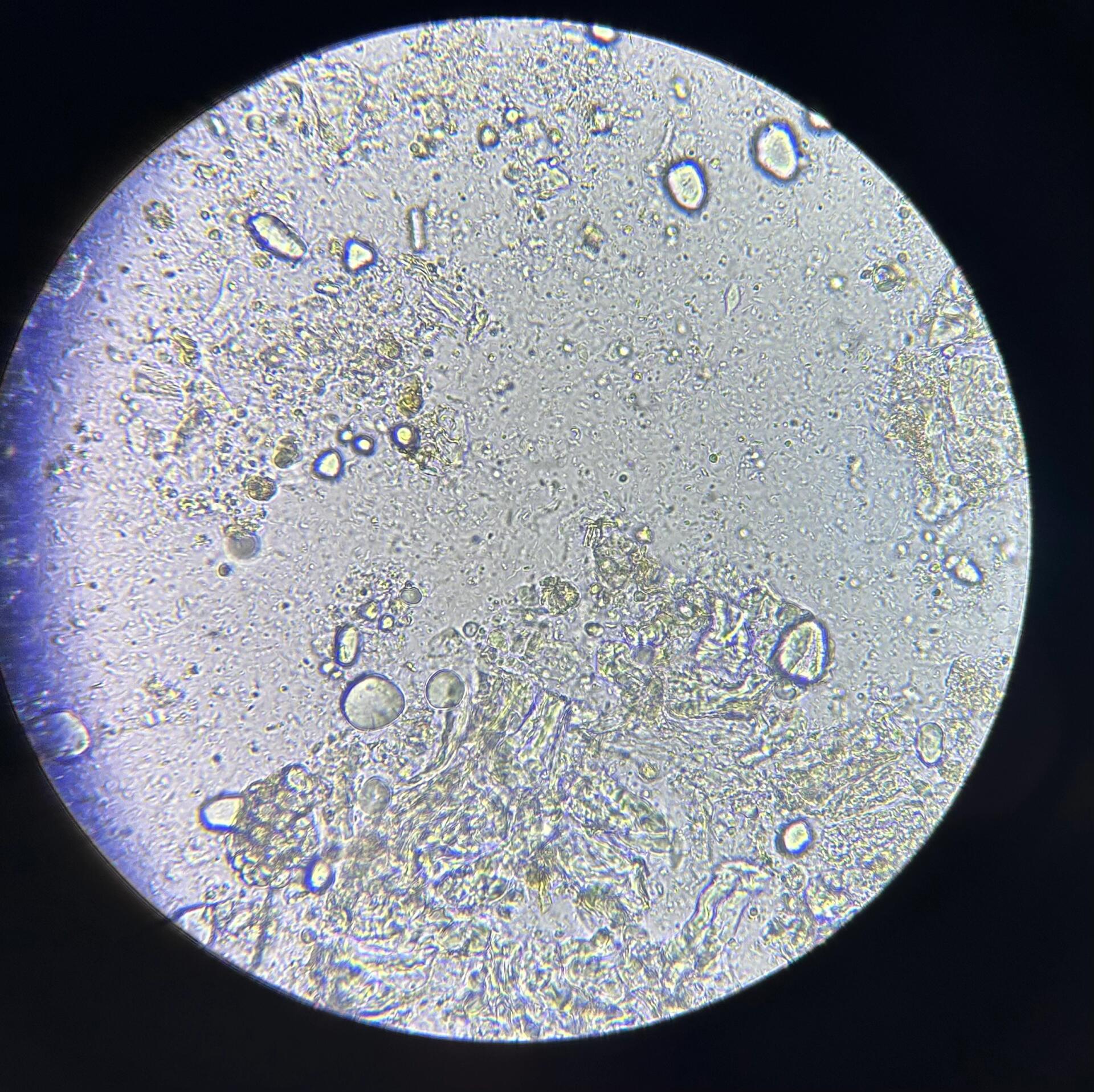 不会还有人不认识三毛滴虫吧