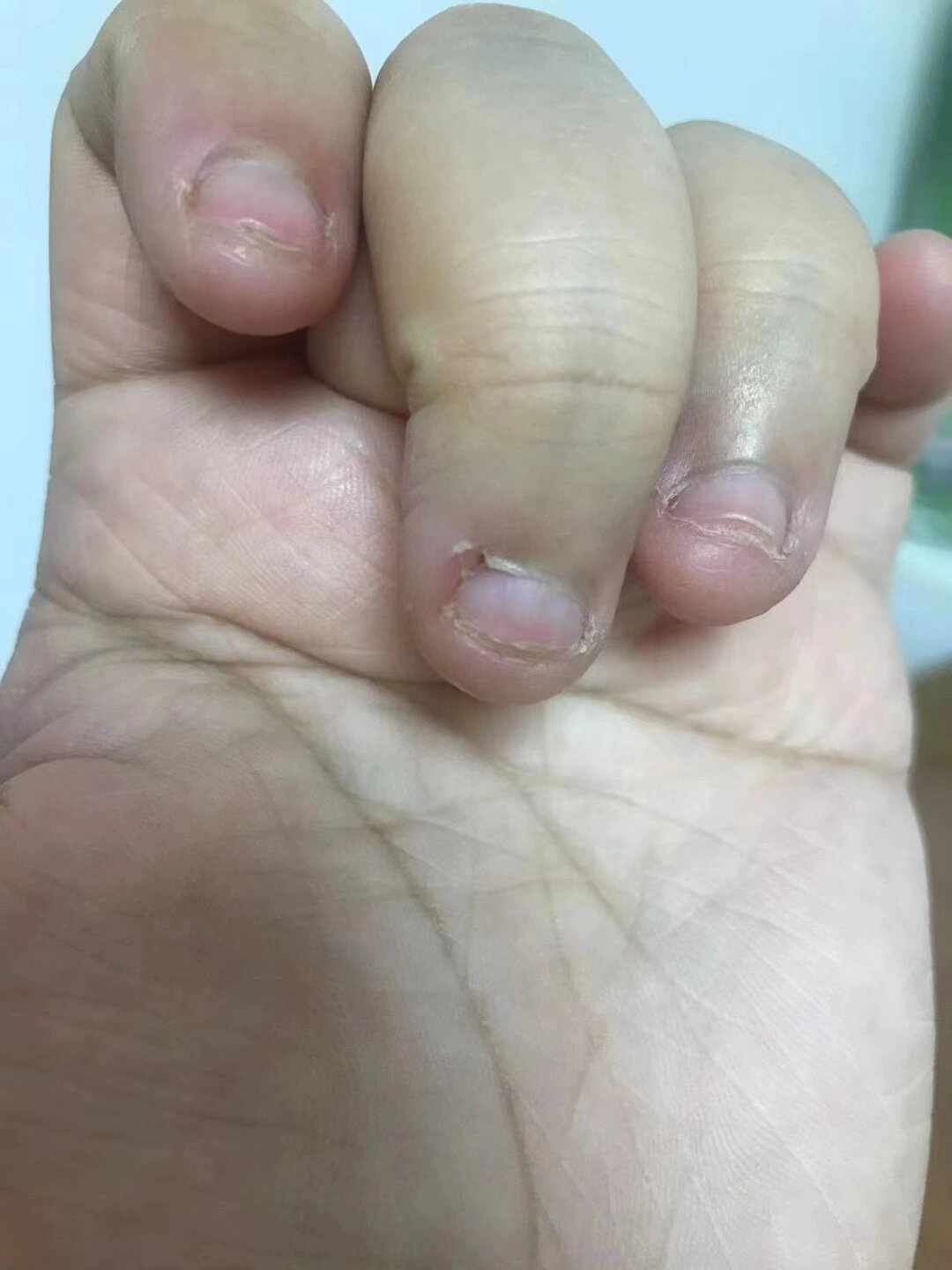 指甲不好看,去做美甲会被美甲师歧视吗