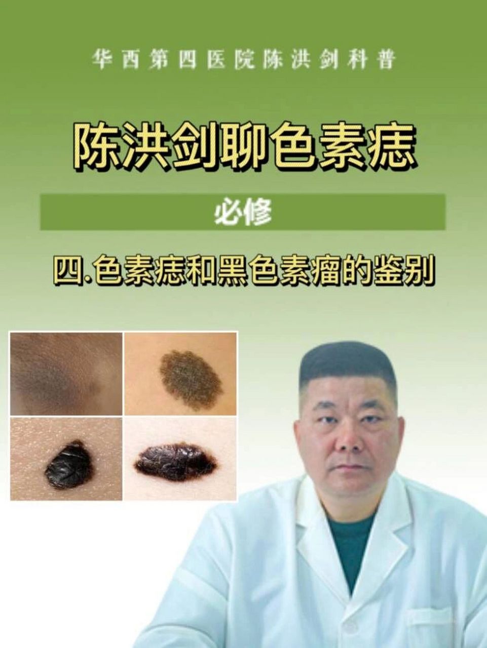 和大家聊一聊色素痣,有问题随时提 色素痣和黑色素瘤的鉴别: ①形态