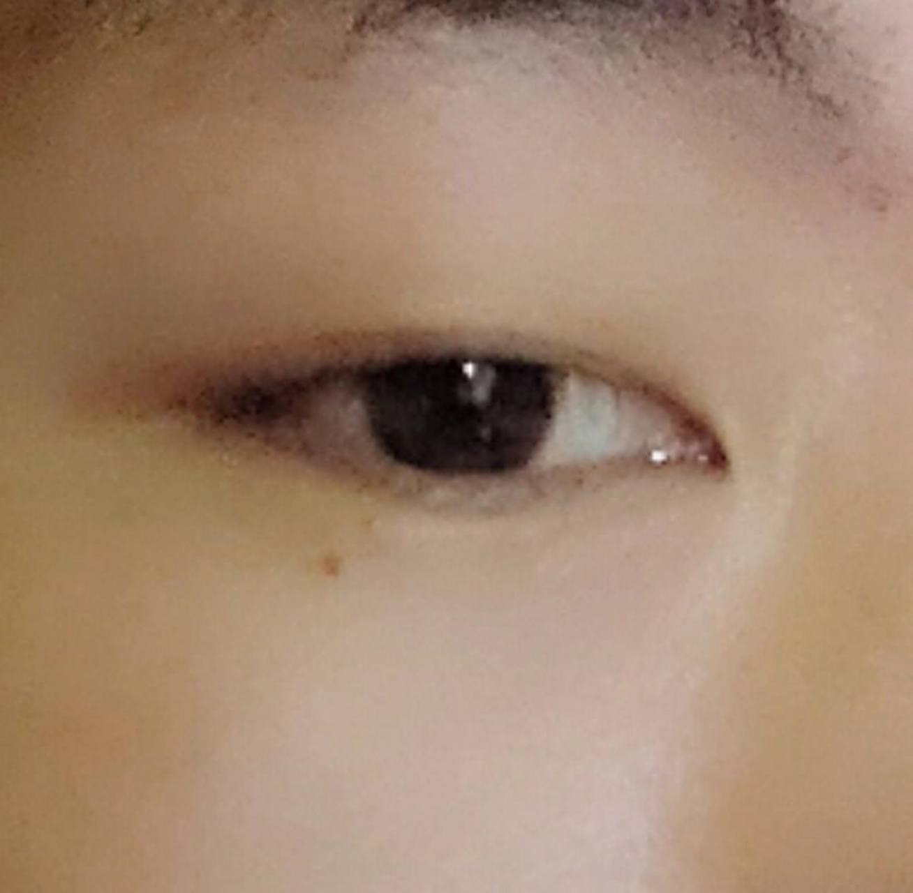 我一直感觉我左边眼睛下边有一颗痣很帅气