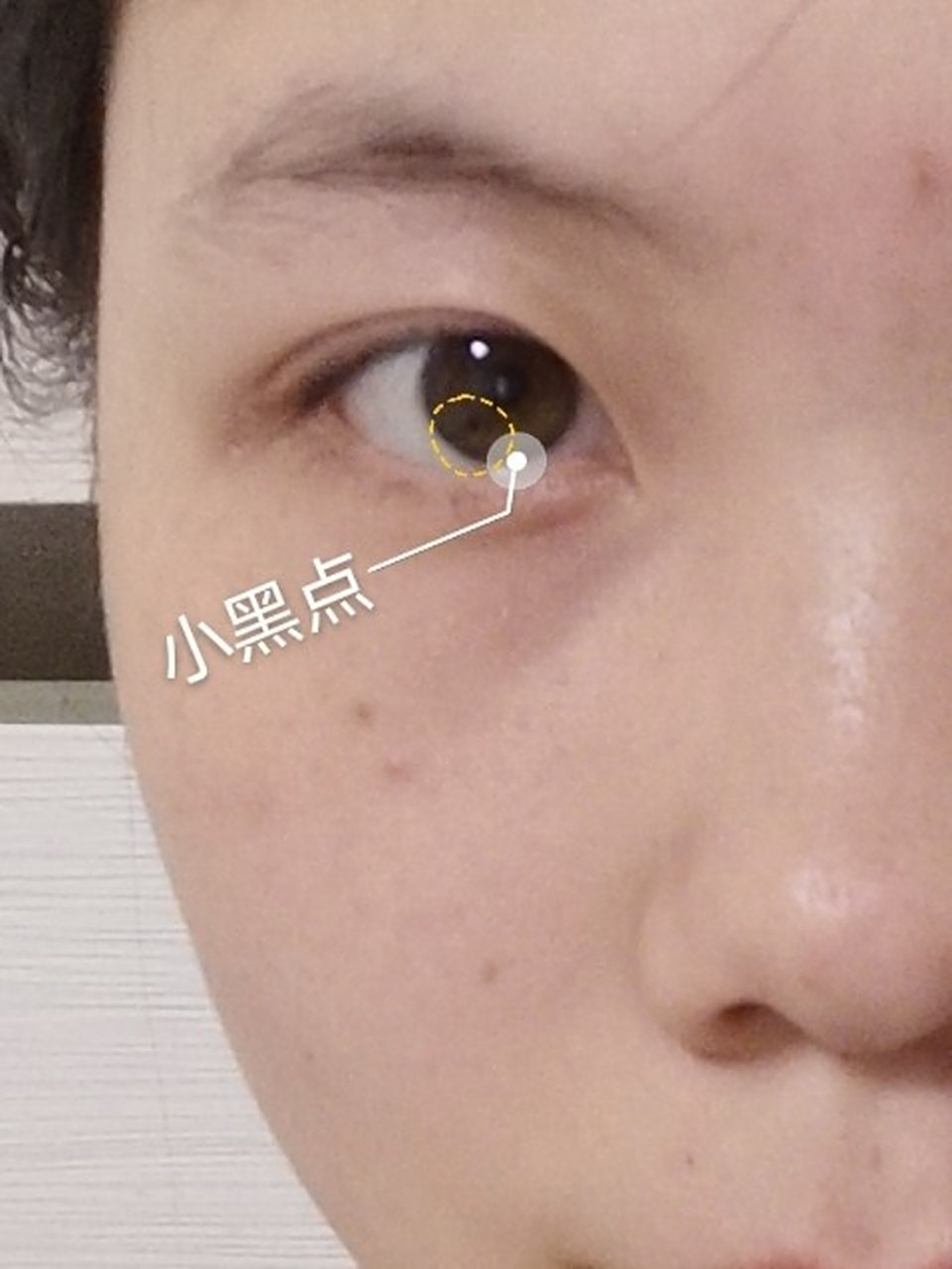 眼睛👀里的小黑点 姊美们 都谁的眼睛里有个小黑点啊 我是从小就有