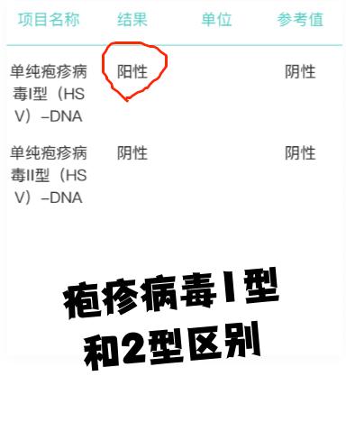  现在比较流行的病毒有哪些名字(现在比较流行的病毒有哪些名字呢)