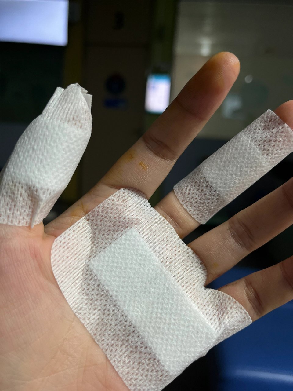 被菜刀切到手需不需要打破伤风 #手指被菜刀切到手# 戳冰箱不小心被