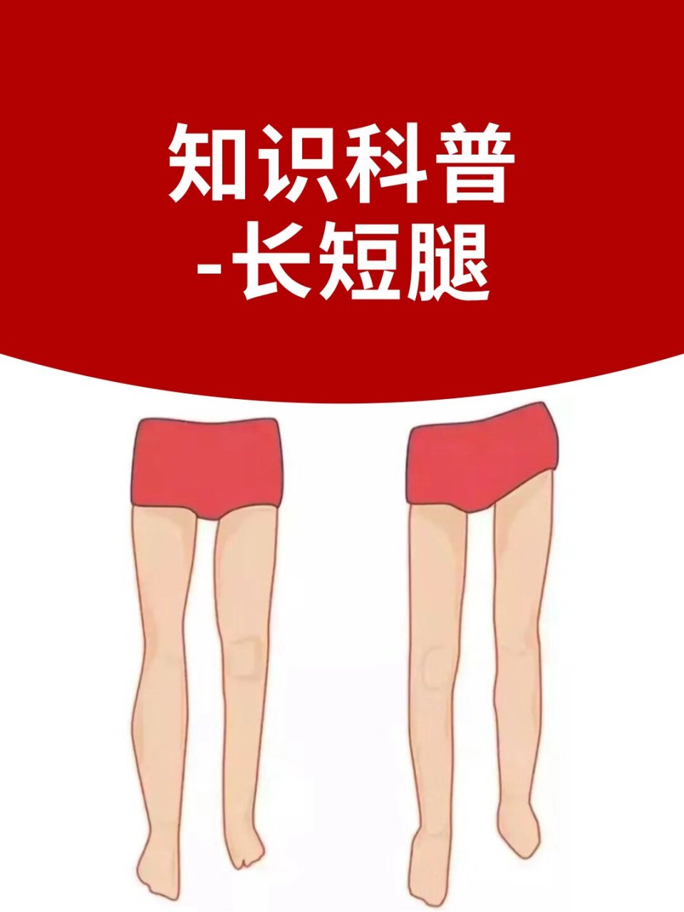 ②如何判定? ③长短腿的成因是什么? ④-⑤如何改善?