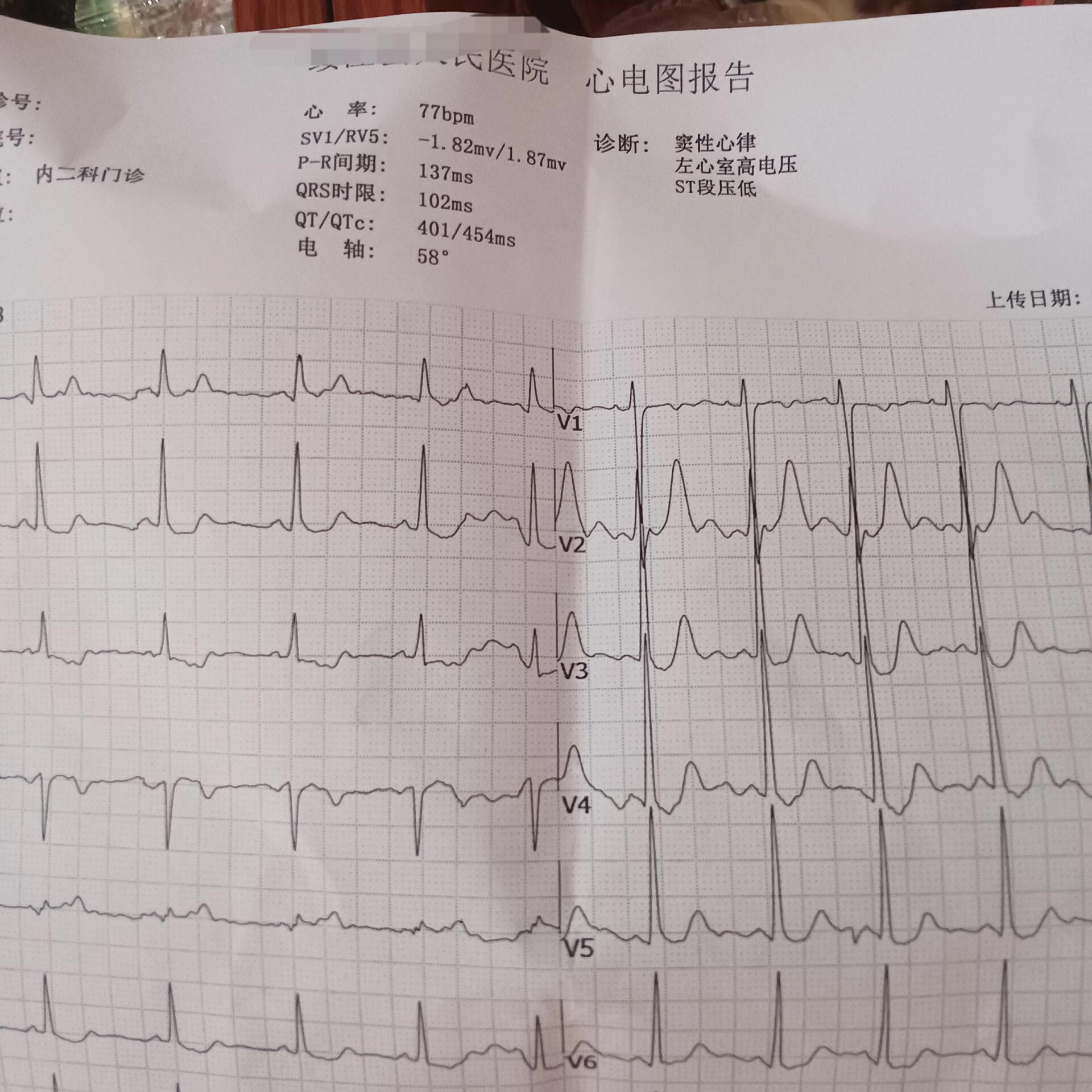 三次心电图都有点问题,但都不一样,抽的血也有点问题,但彩超没问题