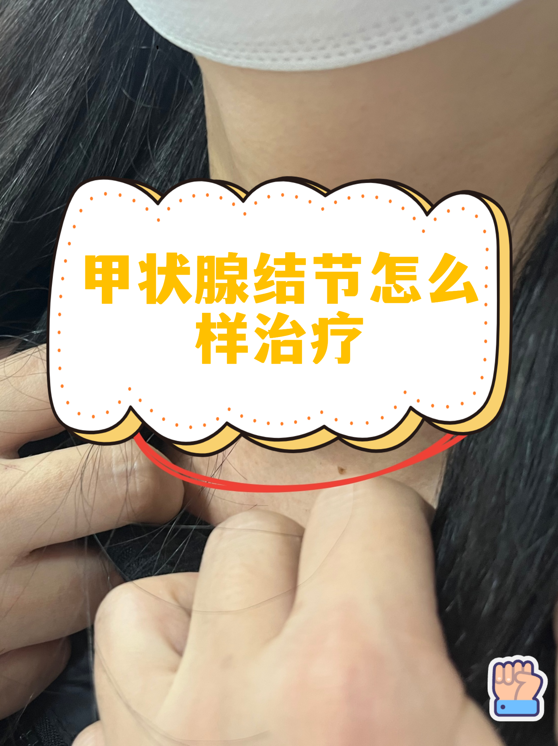 關于同仁醫院檢查陪護加掛號復雜病情綜合分析，治療方向更明確的信息