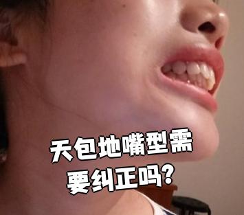 天包地嘴型确实需要纠正