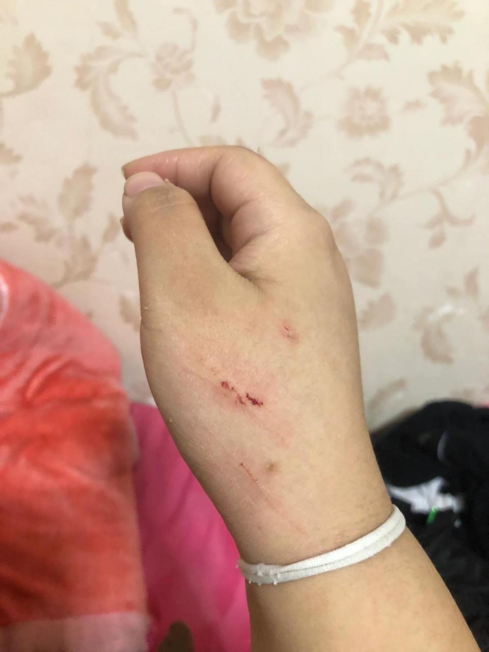 被不到两个月的小猫抓伤要不要打狂犬疫苗17 教育它不能咬人的时候