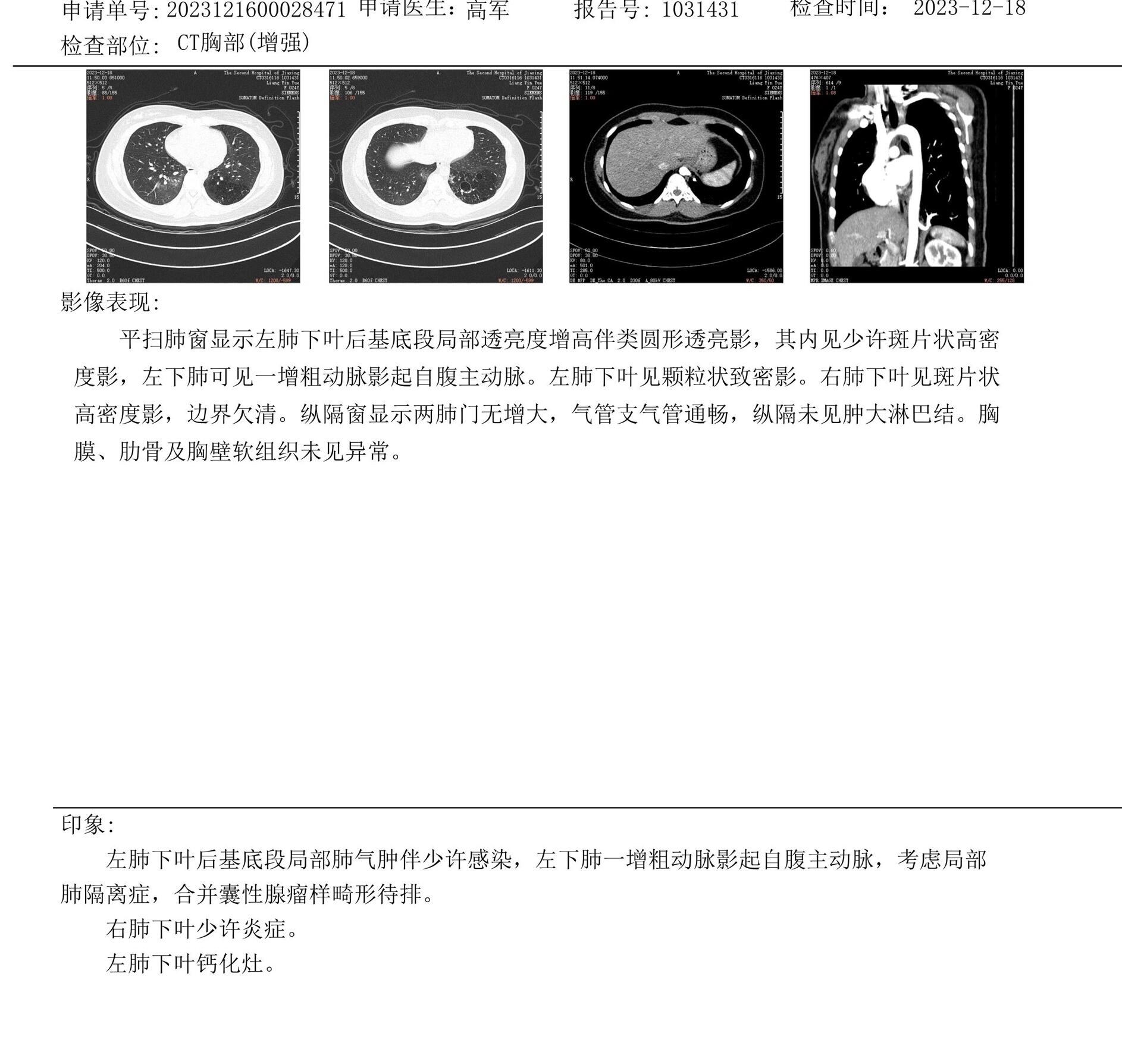 隔离肺手术费用图片