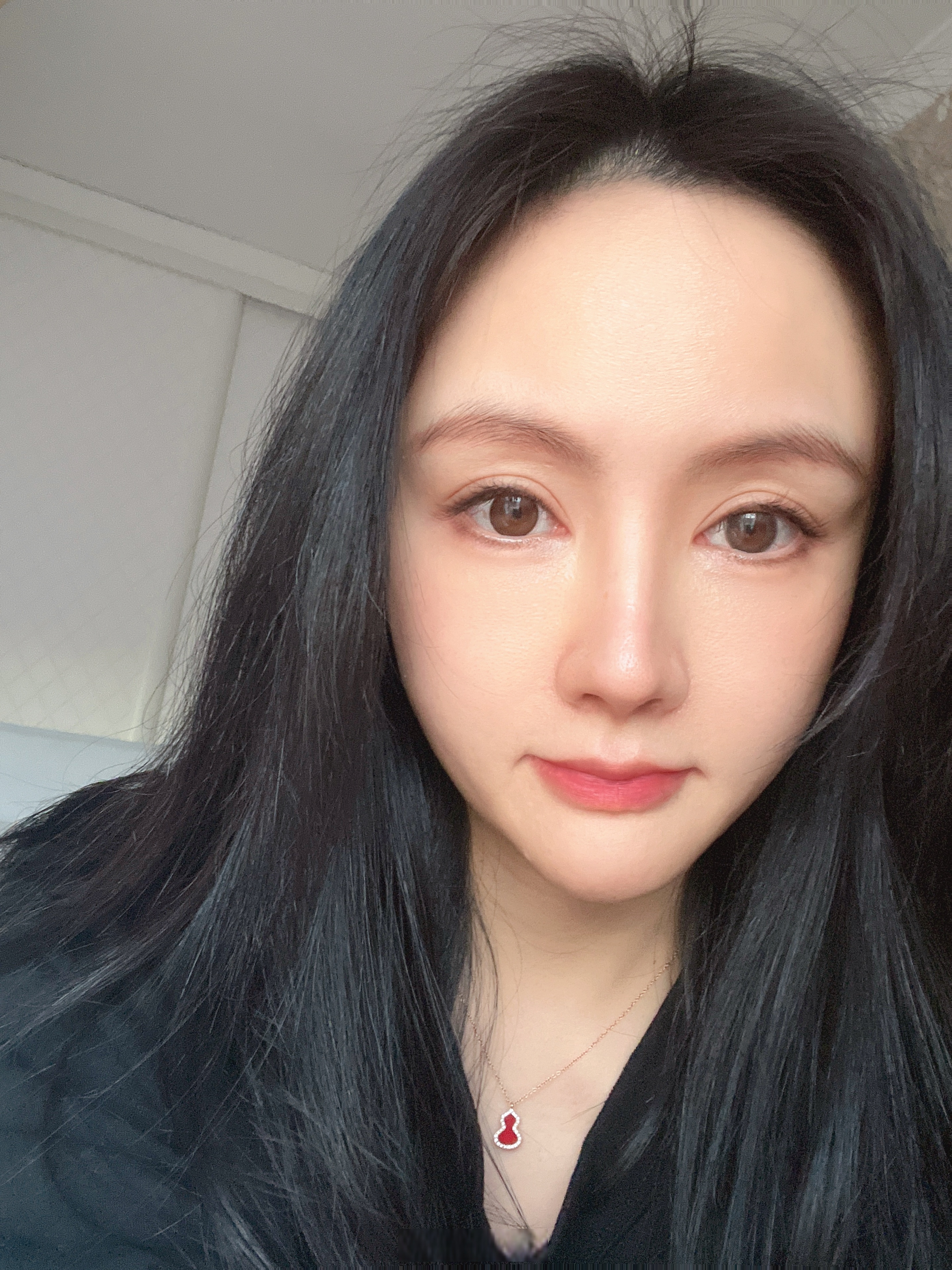 鼻子决定了一个人颜值的上限,鼻子正面好不好看决定了鼻型美观度的