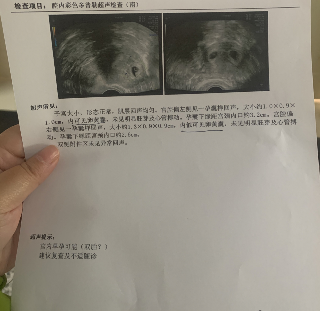 囊胚移植第20天(不含移植日)孕囊来啦 今天是囊胚移植的第二十天,去