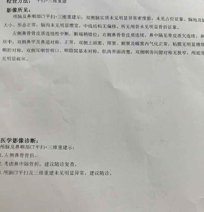 鼻梁一侧骨头凸起常见原因包括外伤,鼻骨发育畸形或感染