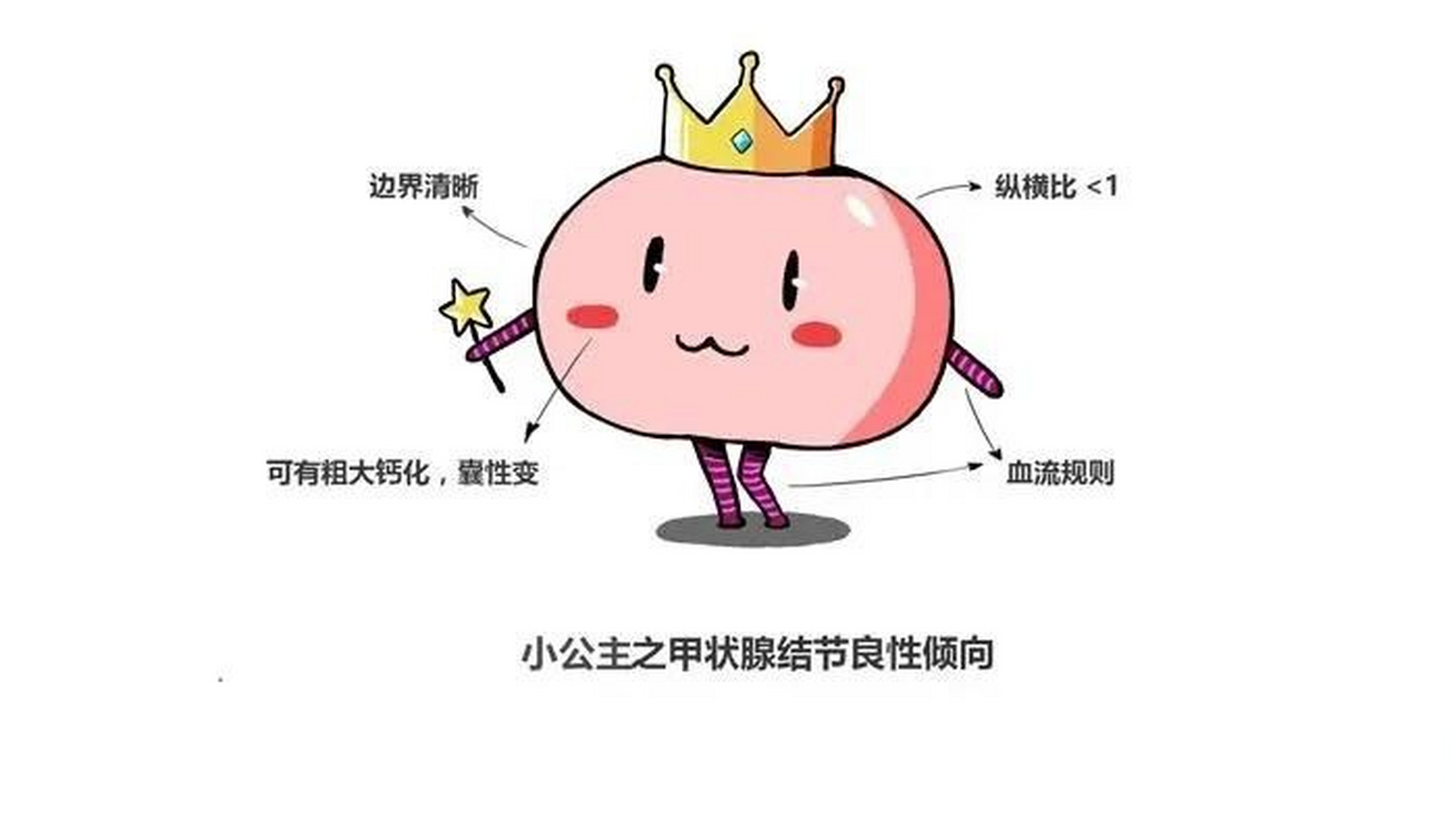 甲状腺结节边缘模糊或不规则,是什么意思?
