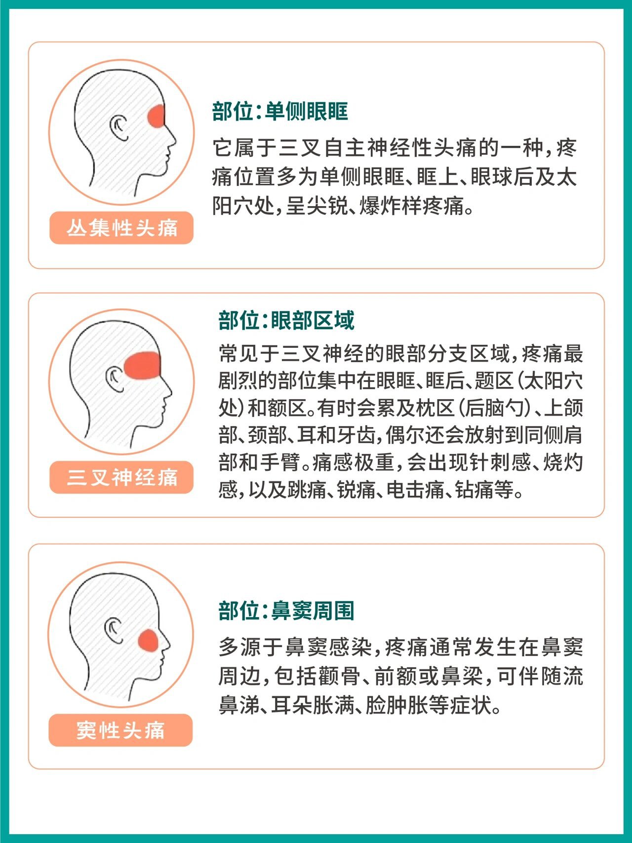 99偏头痛 部位:头部一侧 偏头痛是最常见头痛之一.