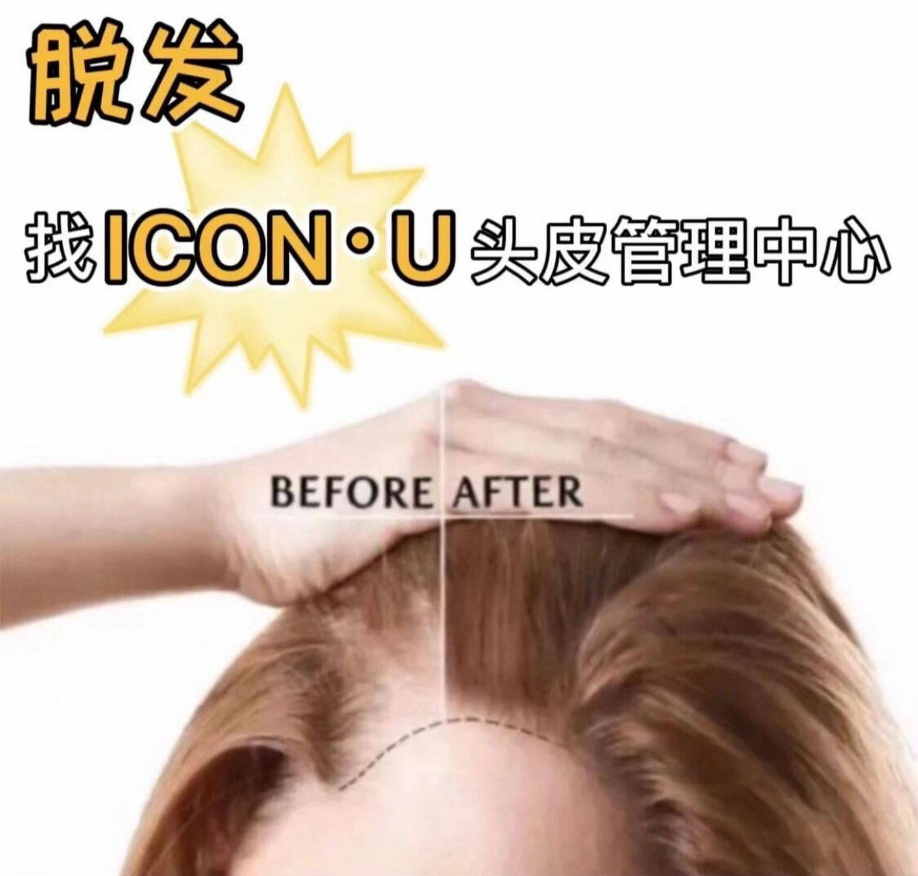 今日份科普小知识 头发的生长速度 头发生长速度的快慢主要和毛囊中