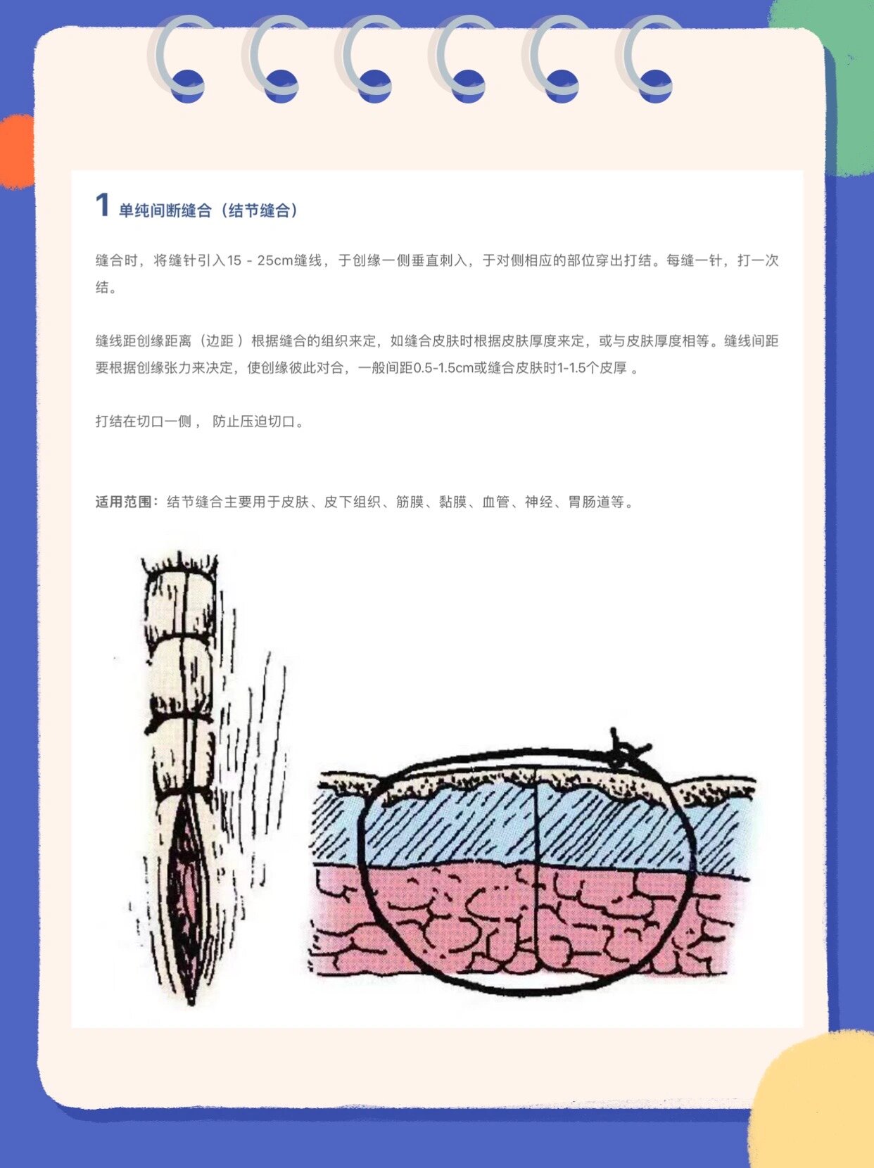 外科13种缝合方法图解图片