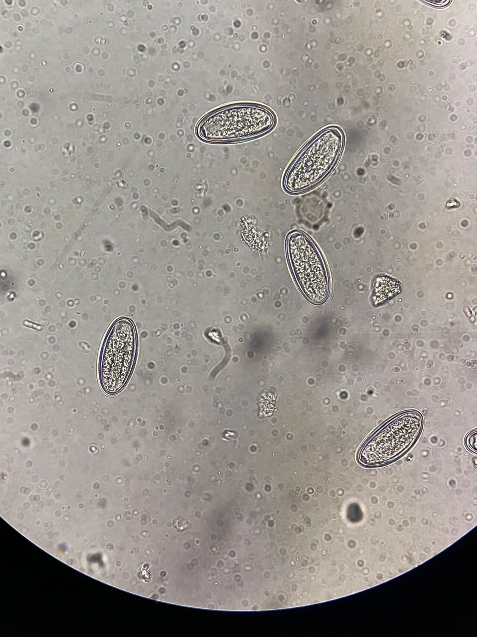 镜下蛲虫卵 第一次遇到,给大家激动坏了都不下班了挤在一起排队看哈哈