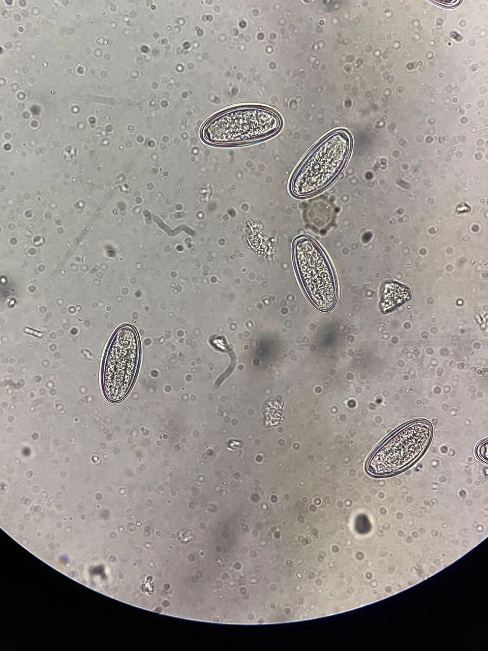 饶虫卵显微镜下图片图片