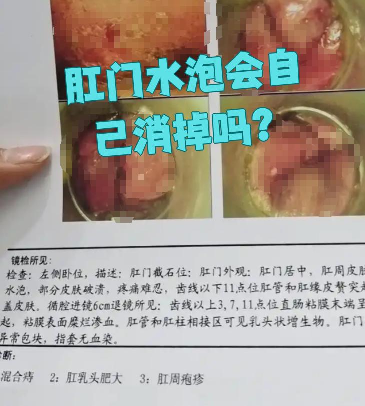 能不能自己好,主要看是什么原因引起的