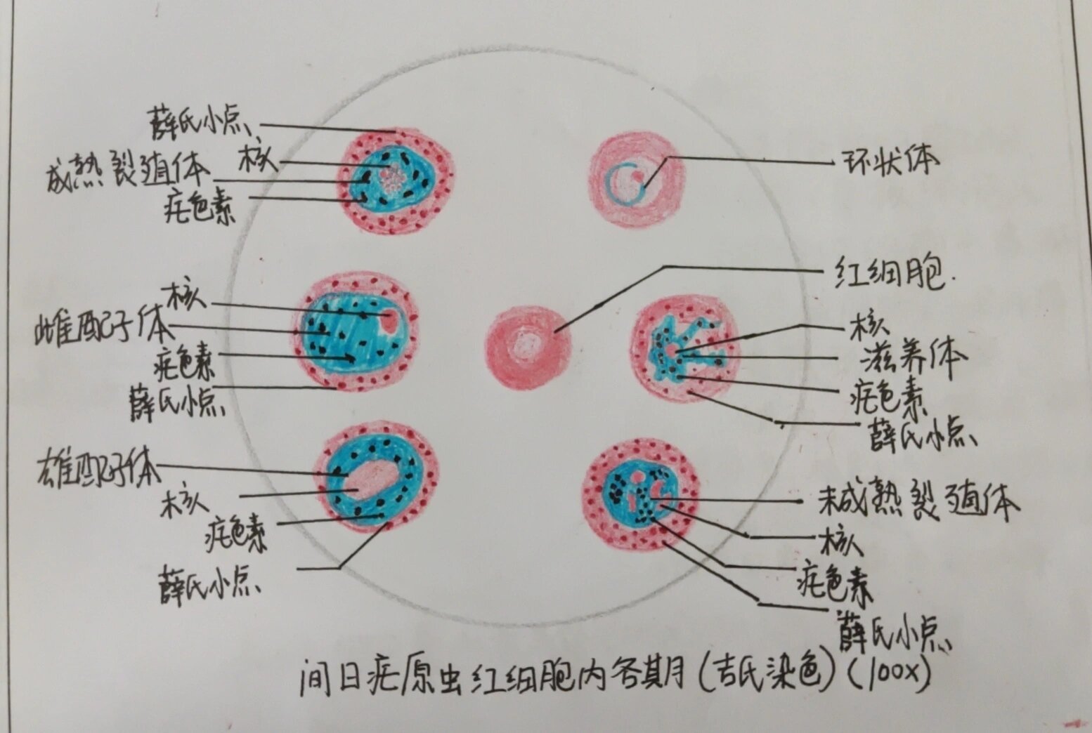 间日疟原虫红内期图片