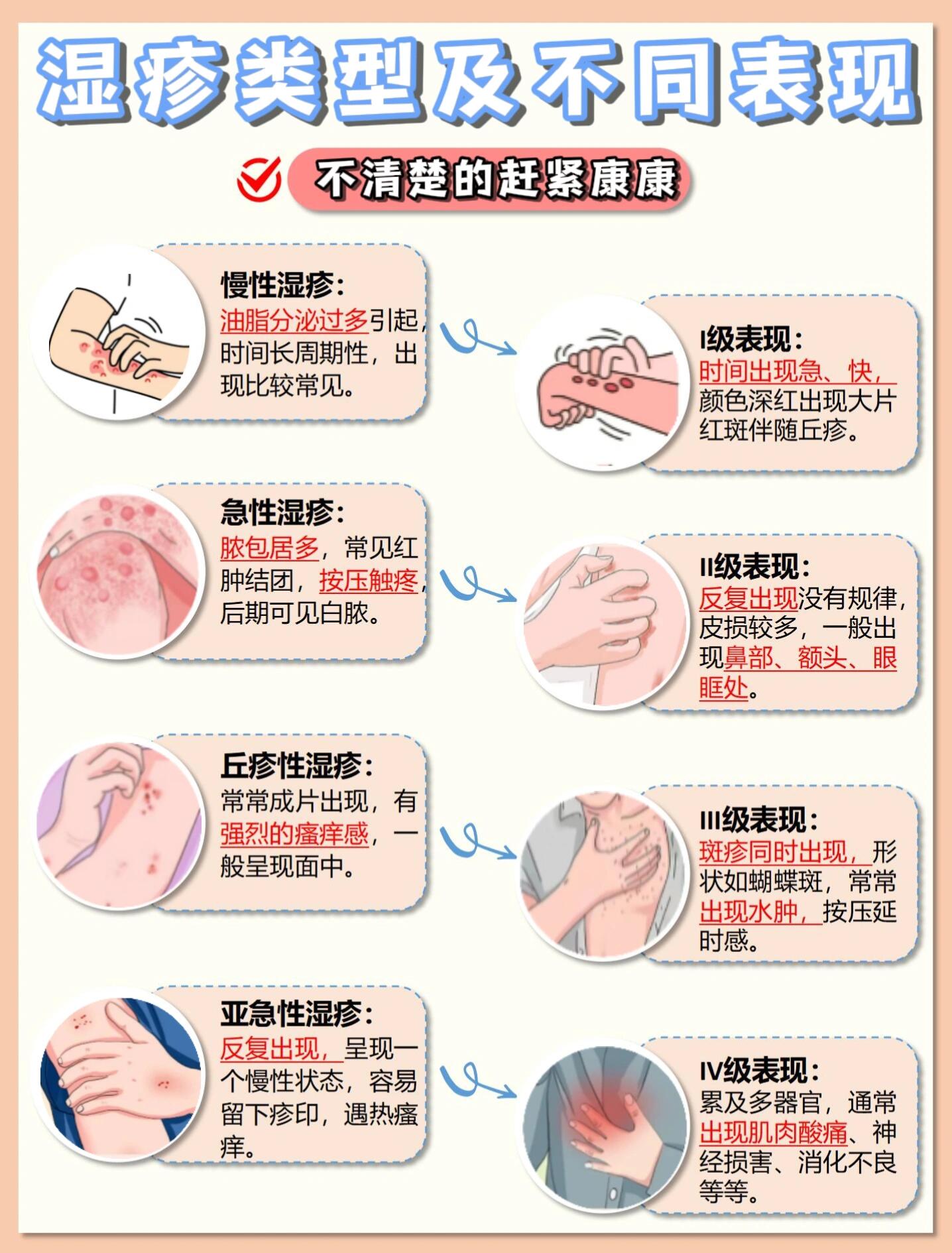 166从发06的原因区分湿疹or皮炎 96湿疹属于刺激引起的过min