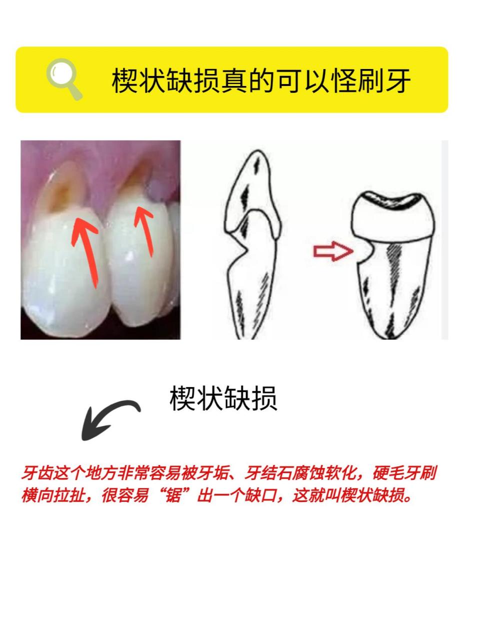 我再说一遍,国际公认科学的刷牙方法,是巴氏(bass)刷牙法,还不知道